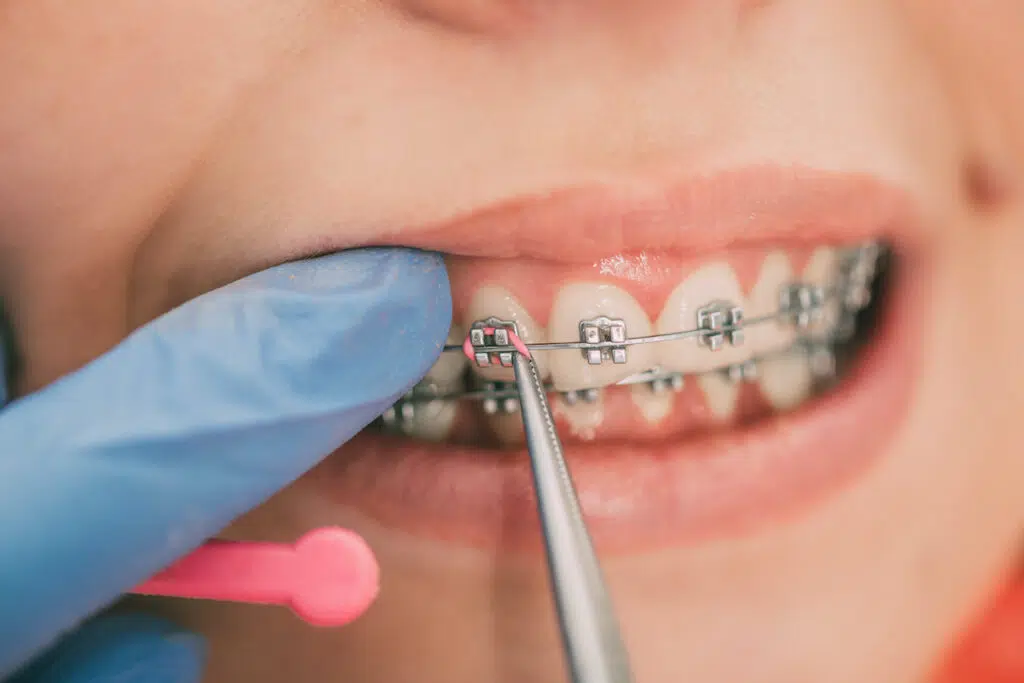 seguros dentales económicos  
